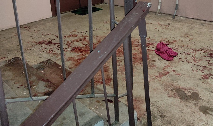 Дочь спала, папа — в крови: подробности конфликта в квартире